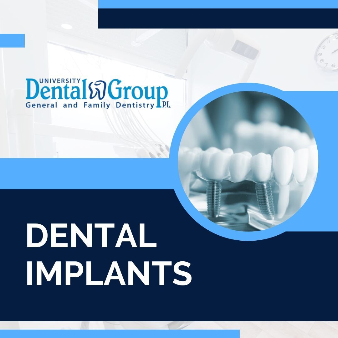 At UDG we proudly offer a variety of services for dental implants. From a single tooth replace to a sinus lift we provide dental care to help YOU! If you have any questions, call our office today!

#UDG #OrlandoDentist #DentalImplants #PreventiveDent