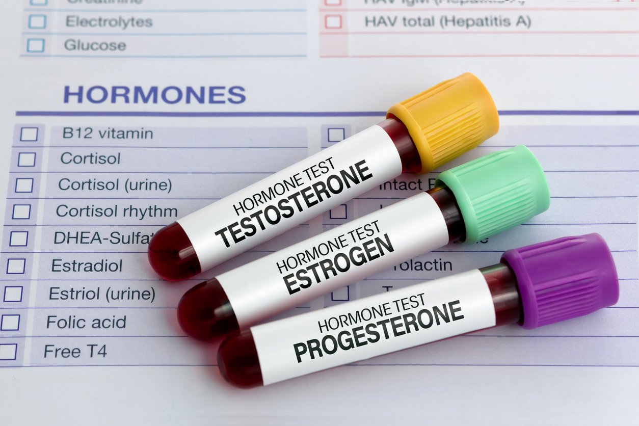 Testosterone, estrogen, and progesterone testing