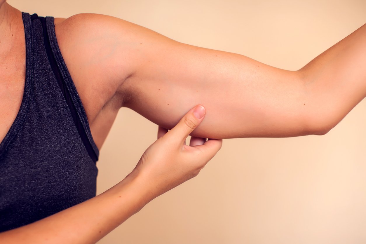 A woman touching her tricep