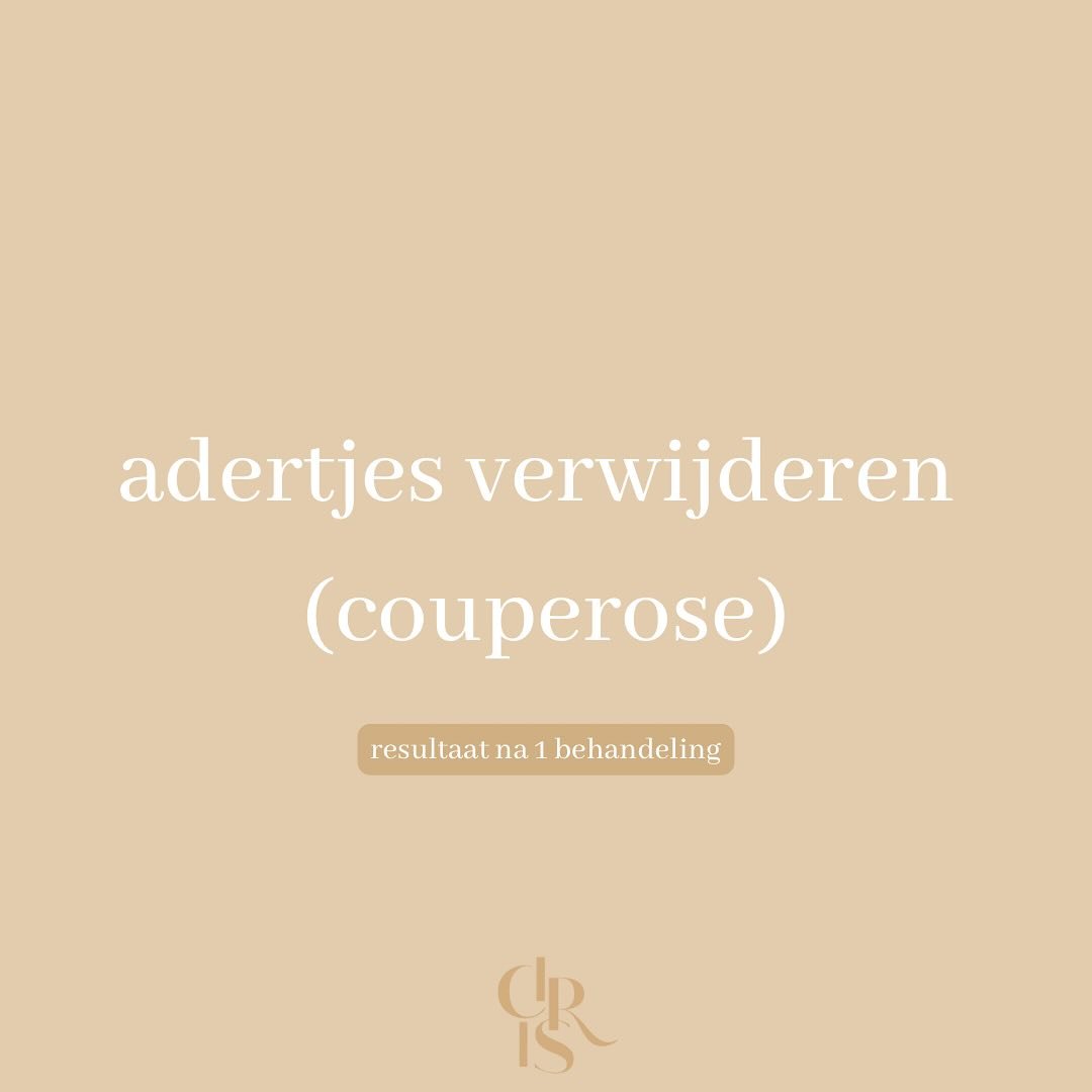𝐂𝐨𝐮𝐩𝐞𝐫𝐨𝐬𝐞 𝐛𝐞𝐡𝐚𝐧𝐝𝐞𝐥𝐞𝐧 ⚡️

Met onze medische clarity ll laser kunnen wij ook couperose aanpakken. 

Behandelplan? 

	&bull;	Aantal sessies: Gemiddeld 1-3 behandelingen, afhankelijk van de ernst van de couperose.

	&bull;	Tijdsduur: E