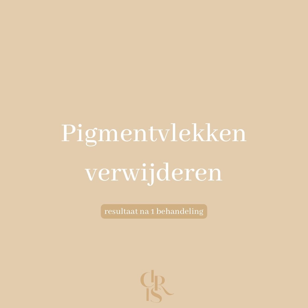 &ldquo;𝐁𝐲𝐞 𝐛𝐲𝐞 𝐩𝐢𝐠𝐦𝐞𝐧𝐭&rdquo;

Een egale huid voor de zomer? YES PLEASE!☀️

Deze pigmentvlekken zijn zichtbaar verminderd na 1 sessie met onze krachtige picolaser. 

Deze lasertechnologie pakt verkleuringen doelgericht aan zonder de huid