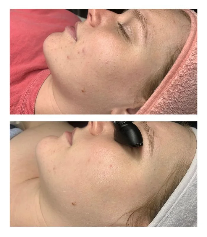 Before and After Face Reality Client 2.jpg