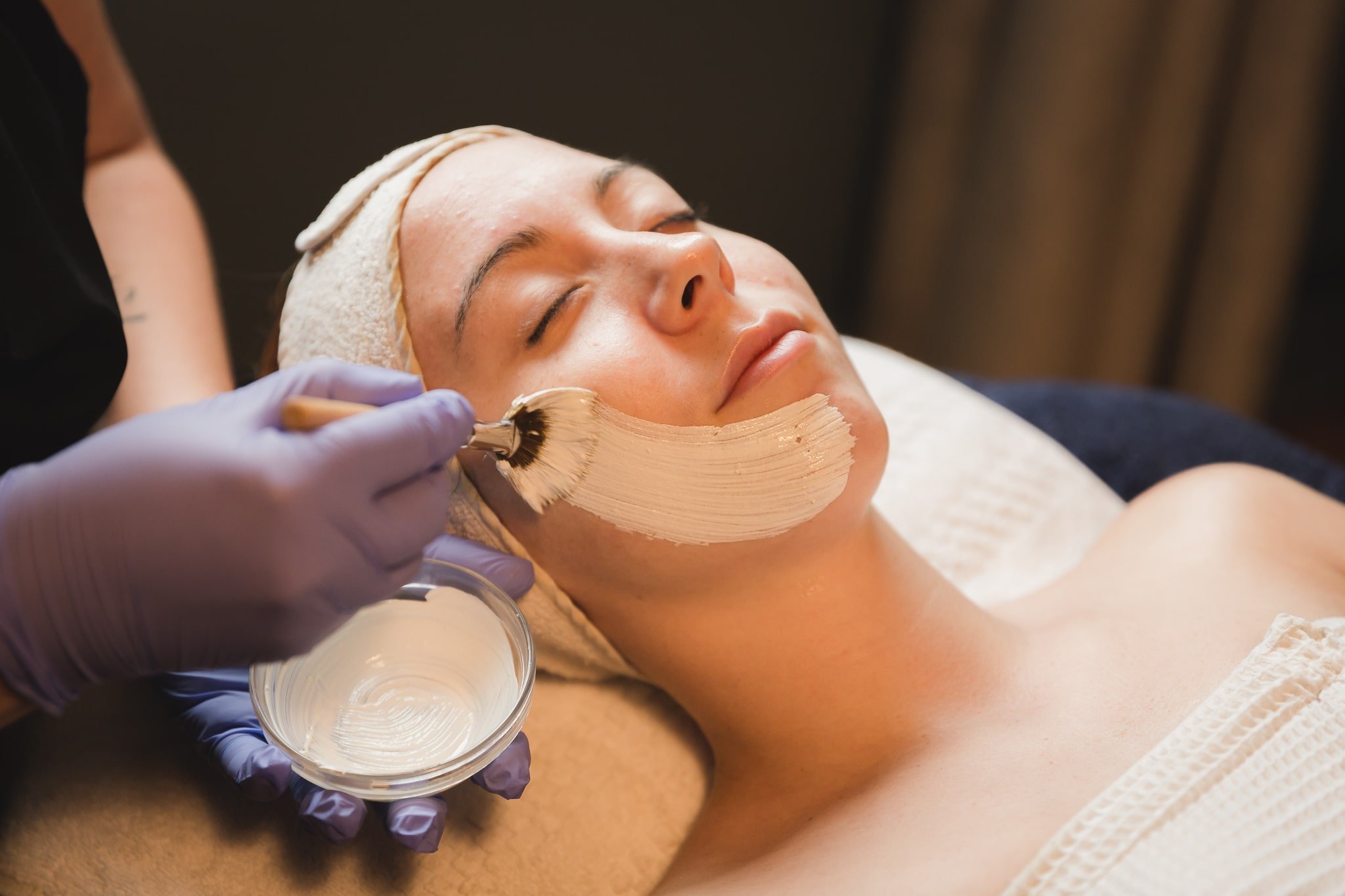 Chemical Peel Buffalo Ny