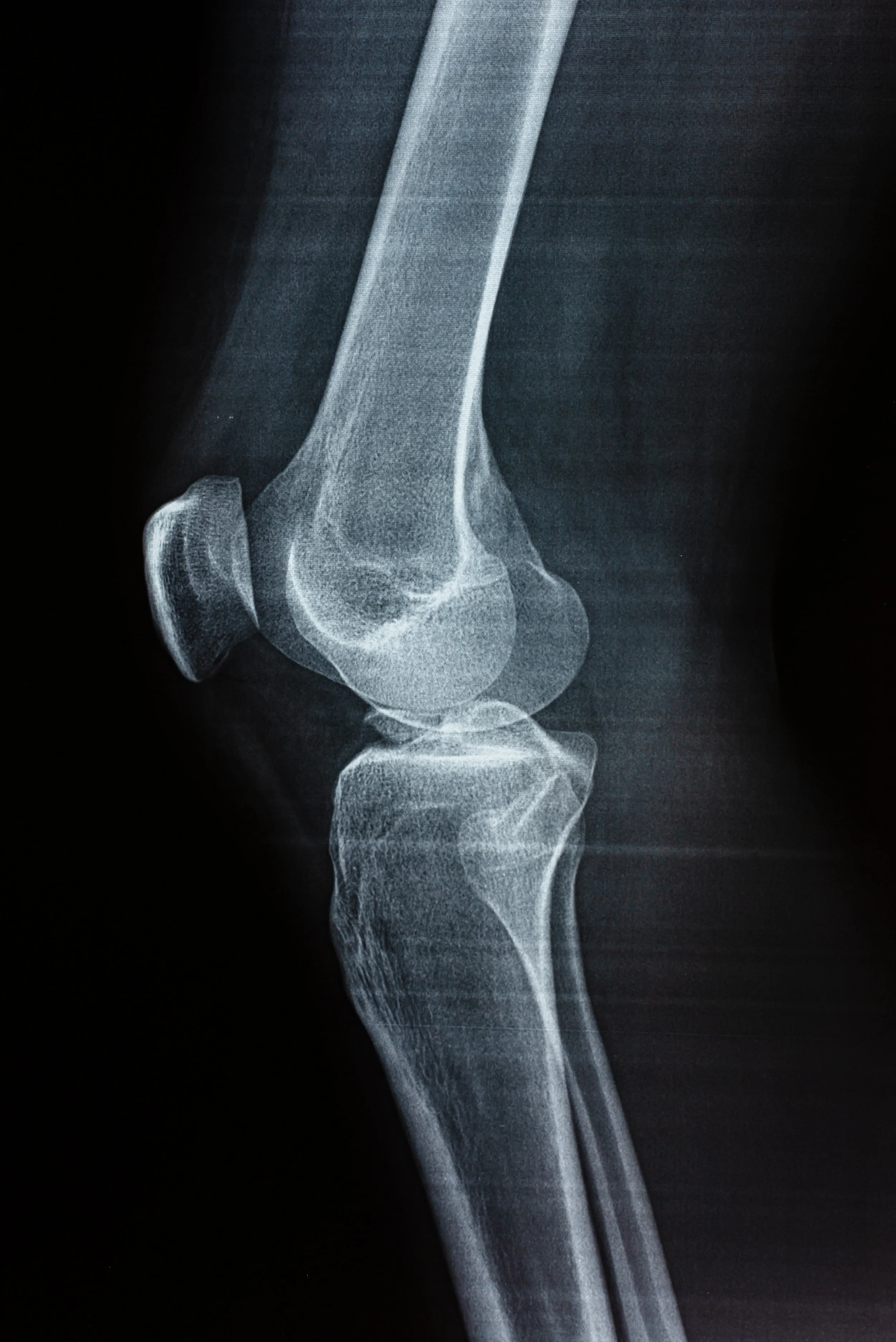 The Knee Intervention - A synchronicity story
