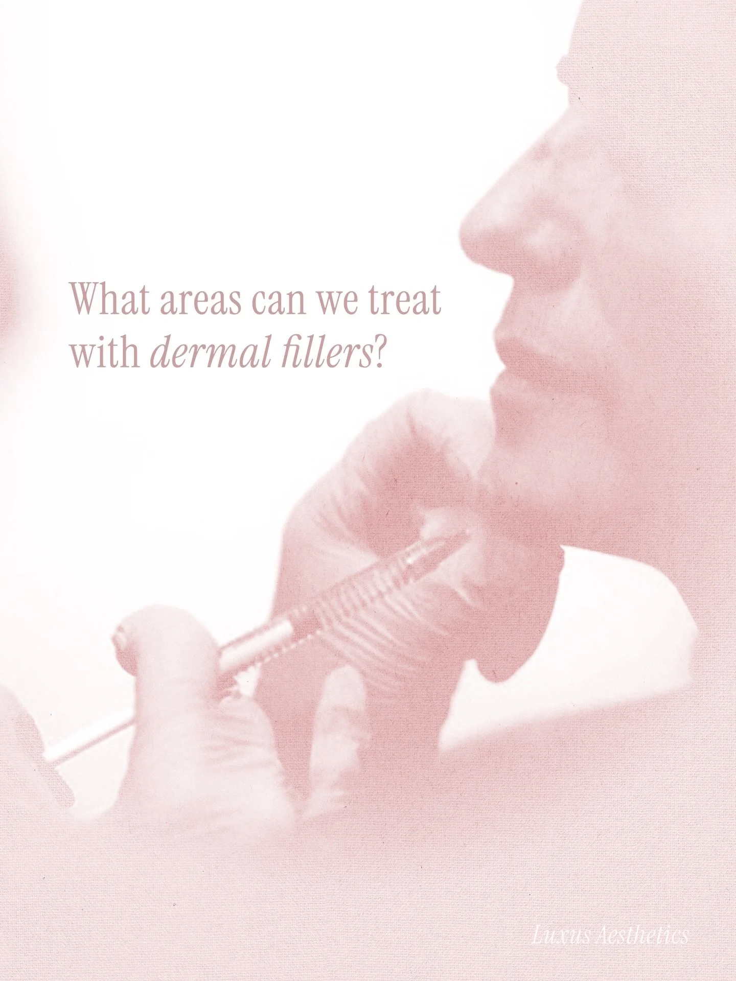 Curious which areas can we treat with dermal fillers? 💉👩🏼&zwj;⚕️

Dermal fillers, when injected thoughtfully and precisely by properly licensed injectors, can enhance facial balance, restore volume, and refine natural contours&mdash;always with su