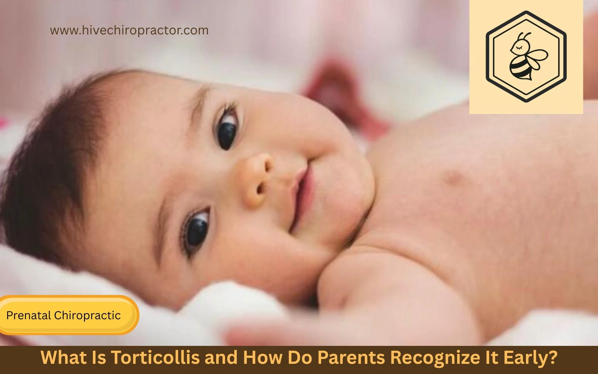 What Is Torticollis And How Do Parents Recognize It Early?