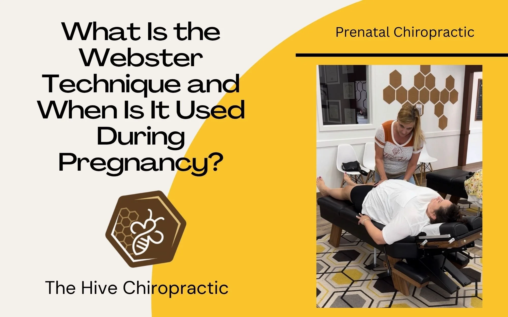 What Is Webster Technique And When Is It Used During Pregnancy?