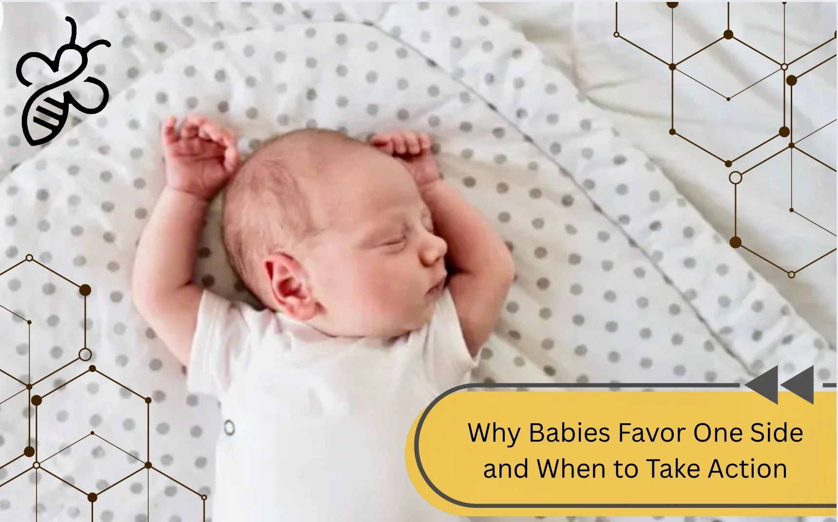 Baby lying on back favoring head to one side during early development