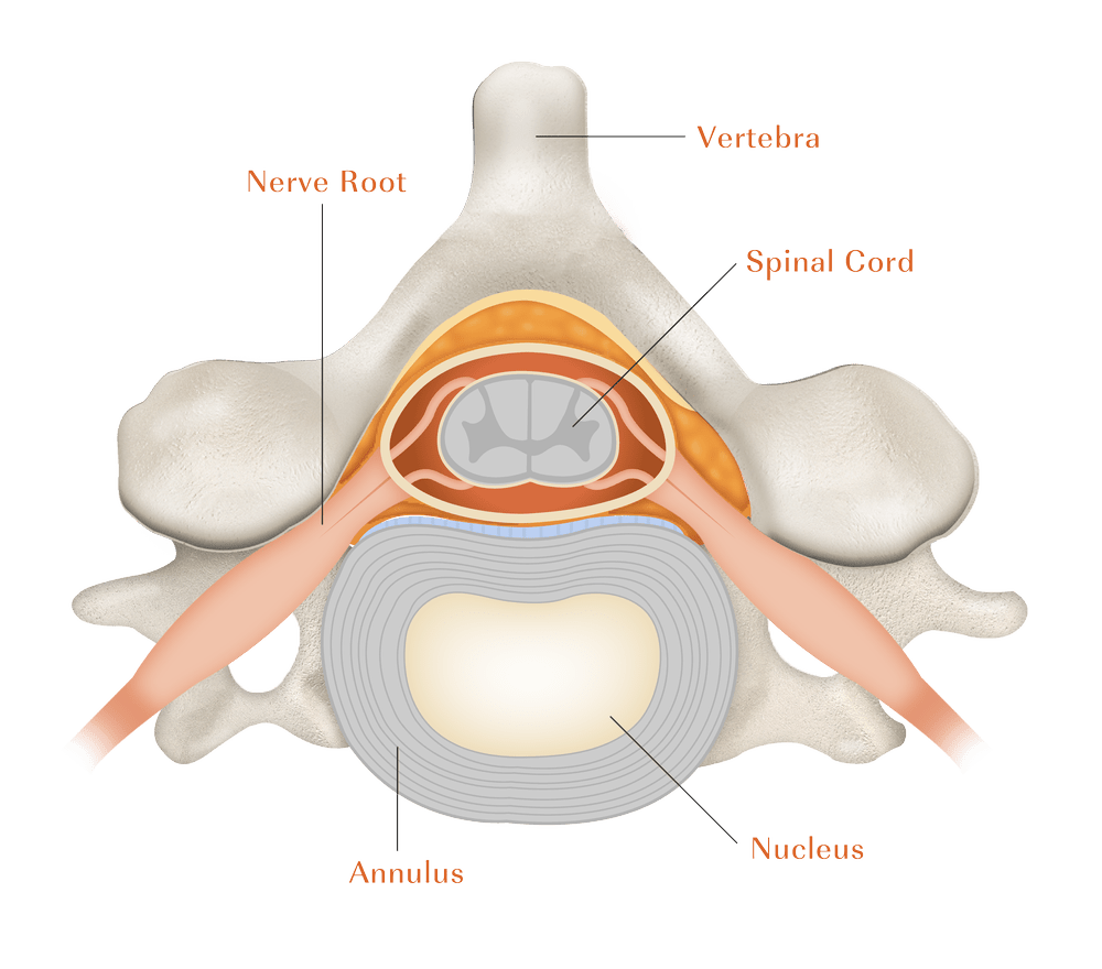 Cervical Spine Patient Education — Camber Spine Med Tech