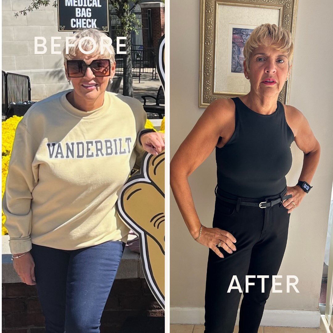 Our patient showing her weight loss results! She lost 34 pounds and has never felt better. With a combination of Semaglutide, exercise, and a personalized nutritional plan, she was able to lose weight and be in the best shape of her life! 

Link to b