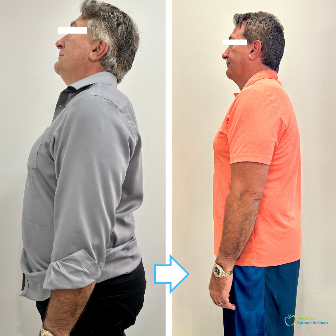 Mounjaro Weight Loss