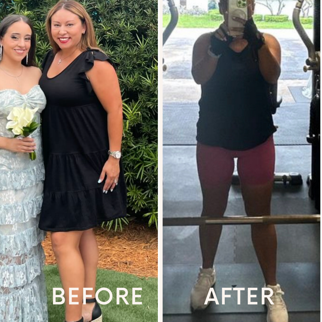 Miami Weight Loss Transformation