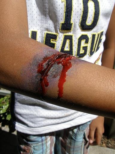Face-Painting-Injury-3.jpg