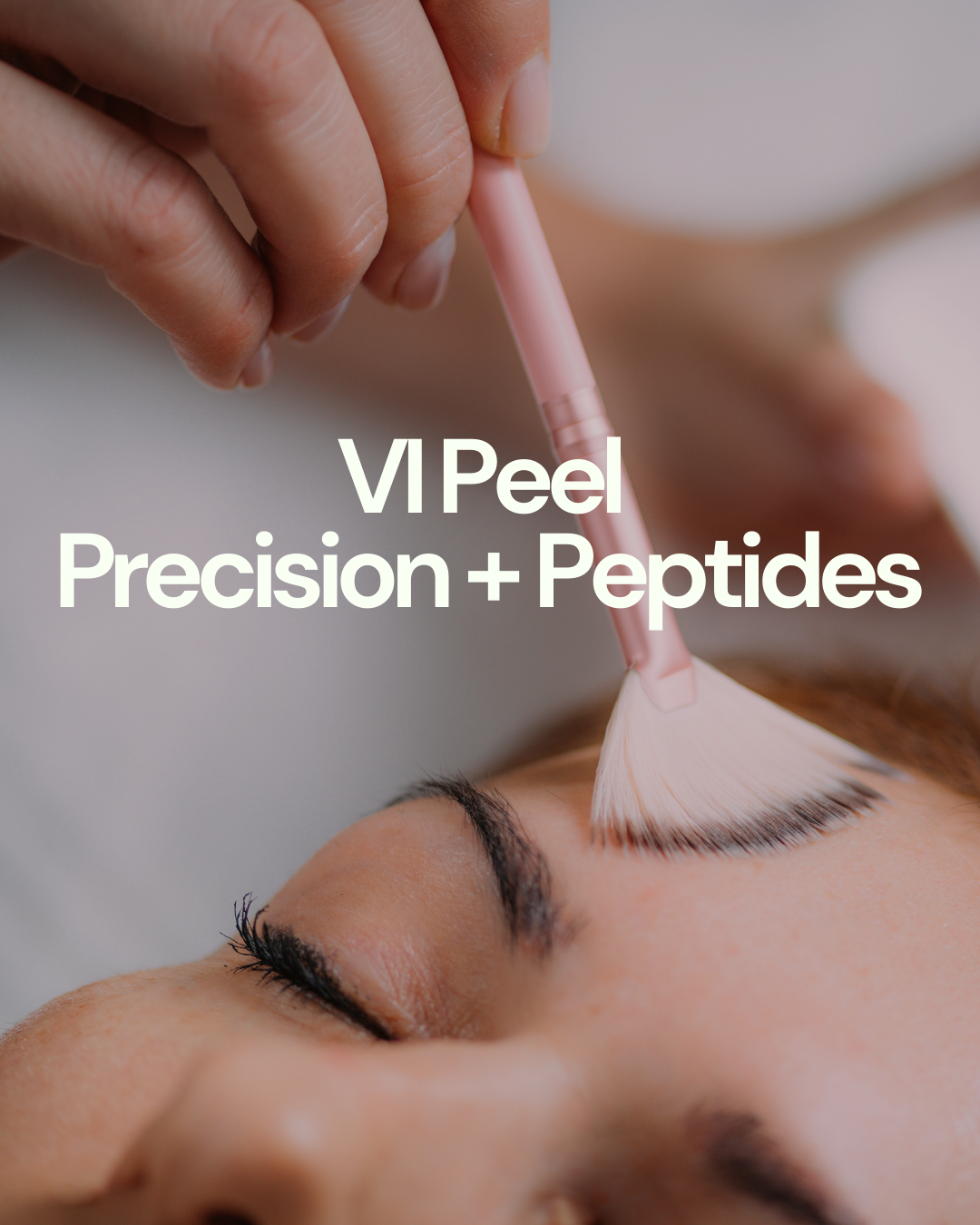 VI Peel Precision + Peptides