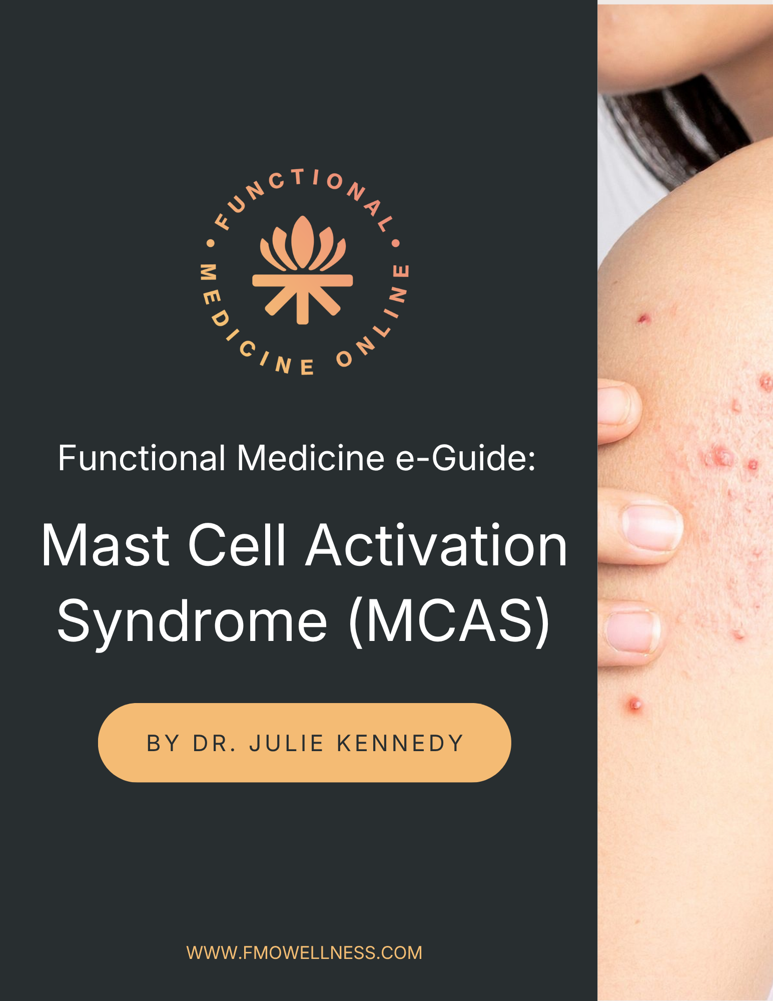 Functional Medicine E-Guide: Mast Cell Activation Syndrome (MCAS)