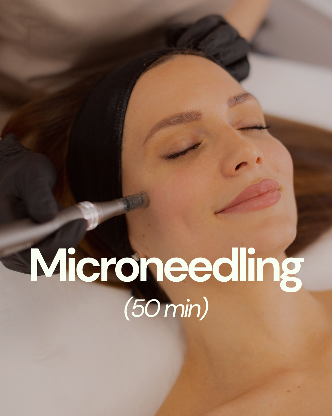Microneedling