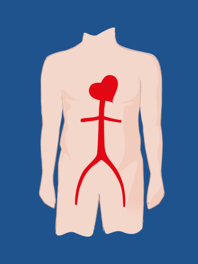 A digital illustration of a human body with the heart and blood vessels highlighted in red, without a head.