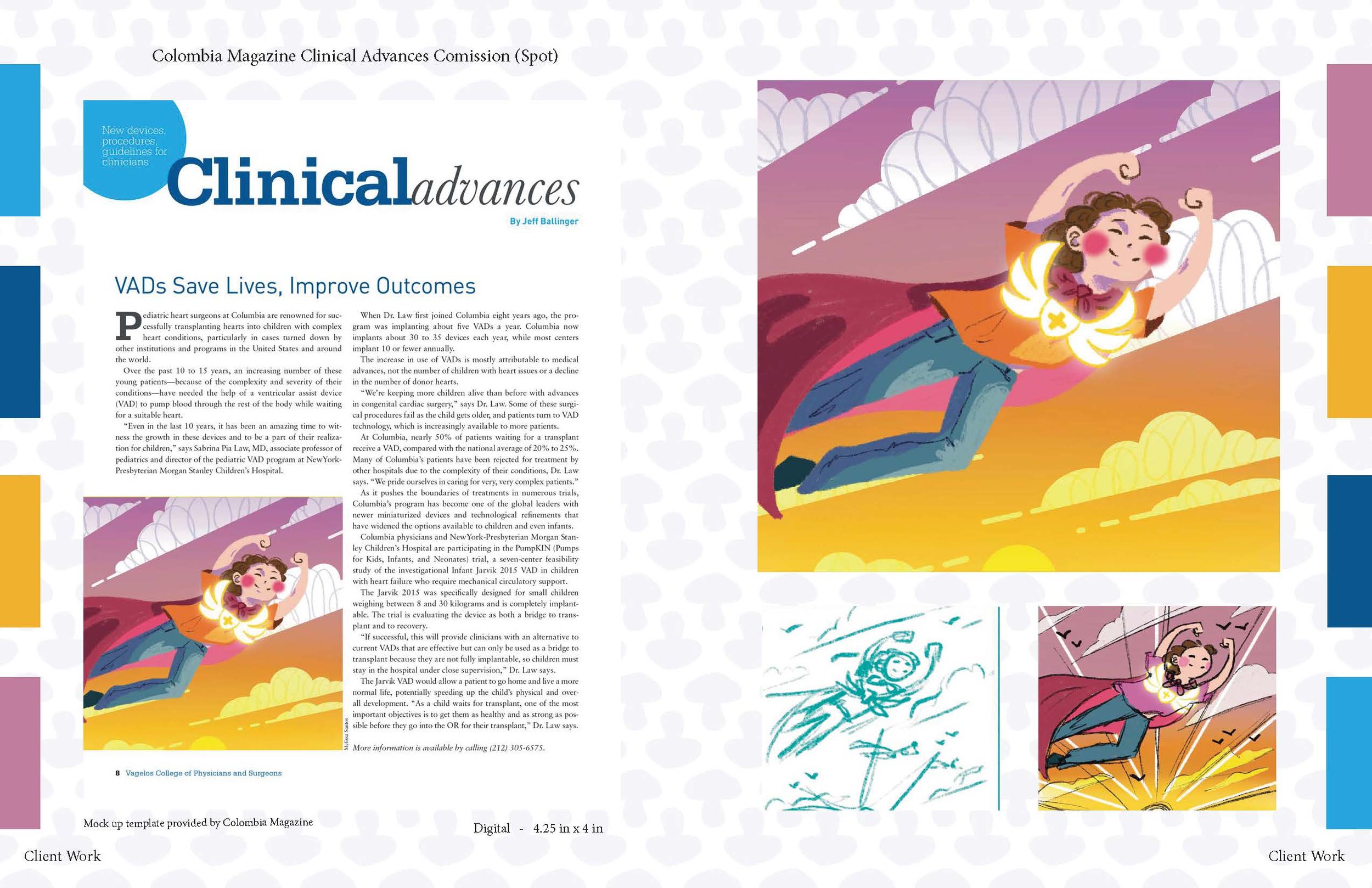 This piece was a potential spot illustration for a Colombia Magazine article about an advancement in the medical field. The piece on the right is mocked up in the article on the left and shows a child with a heart problem being free through this devi