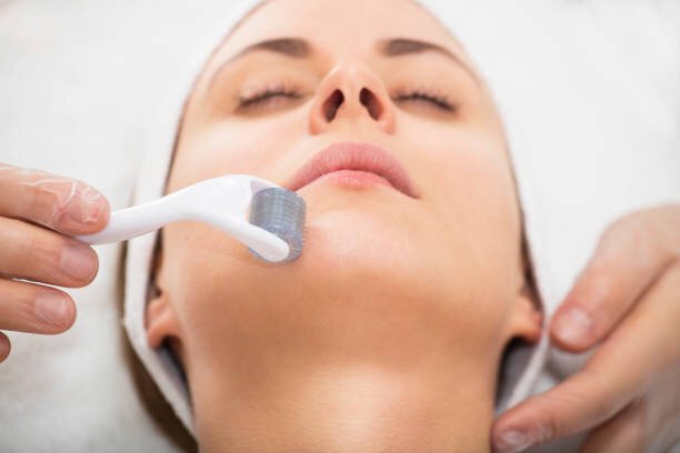 How microneedling can improve your skincare routine