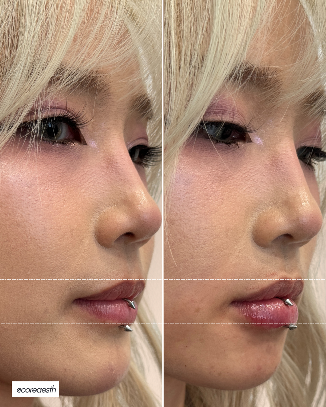 Close-up side-by-side comparison of a person's face highlighting makeup. The left image shows subtle makeup with shimmer near the eyes and nude lips. The right image features glossy lips and the same eye makeup. Both images show the same person with light blonde hair, emphasizing changes in lip gloss application.