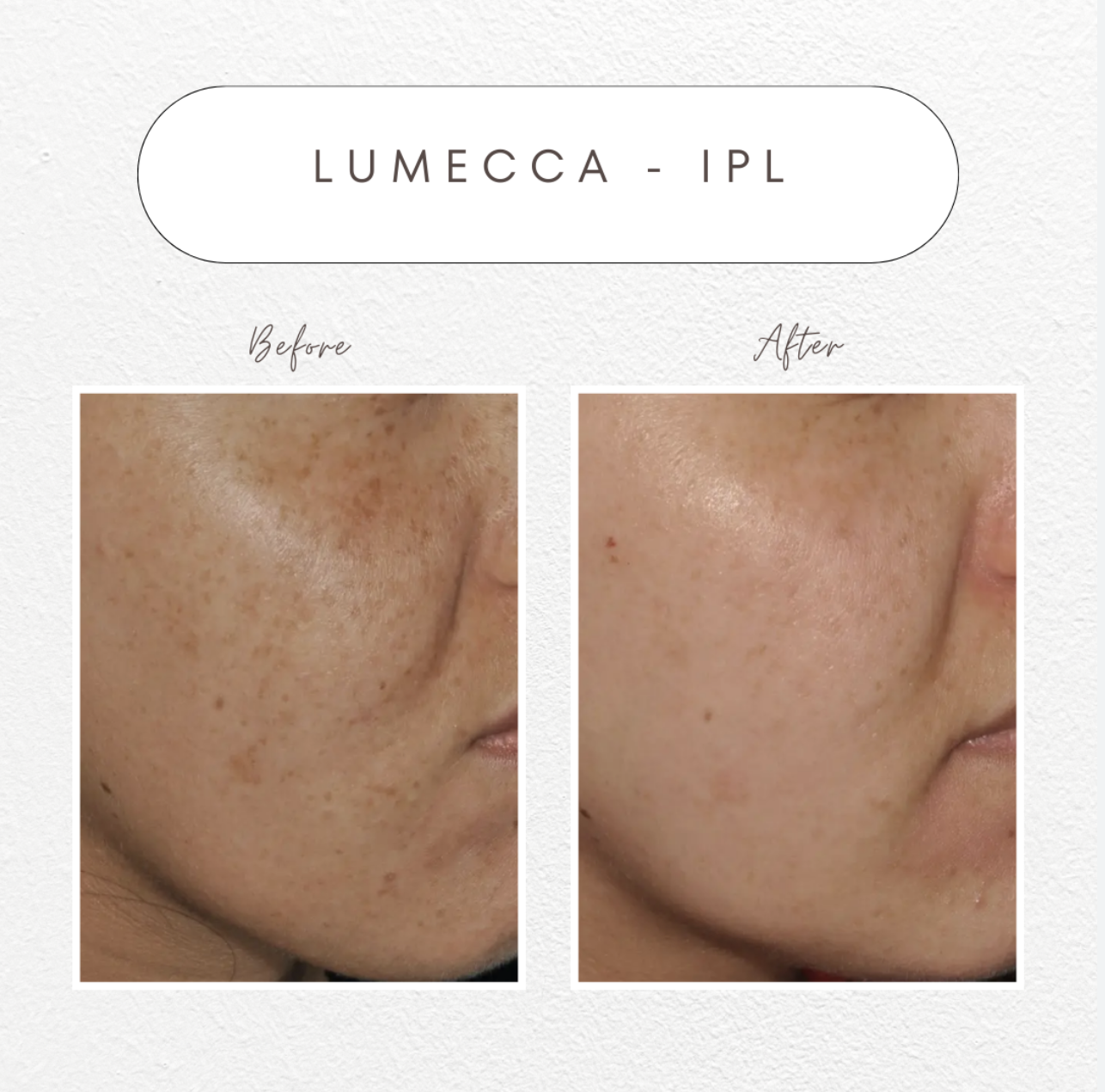 How Many IPL Sessions Do You Really Need?