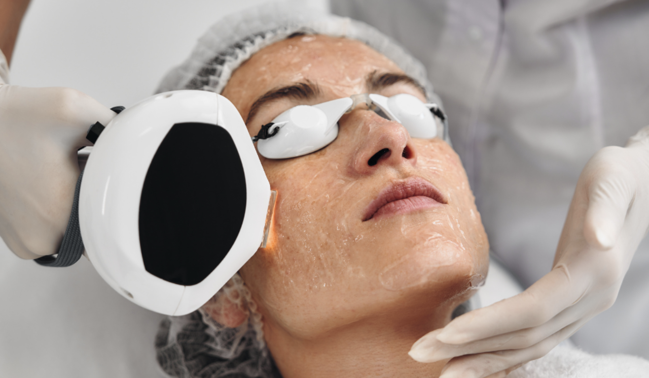 How Fast Will I See Results After IPL? The Realistic Timeline