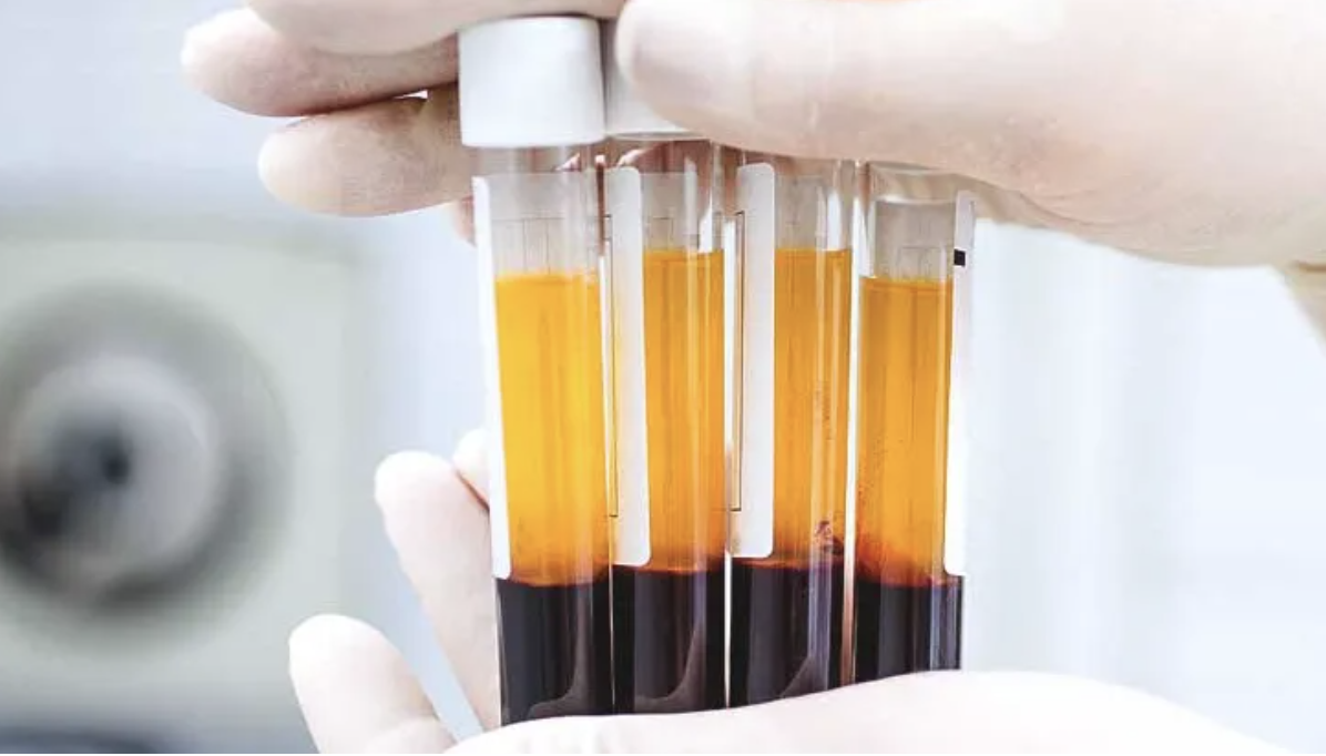 CoolPeel + Exosomes or PRP: The Ultimate Skin Regeneration Duo