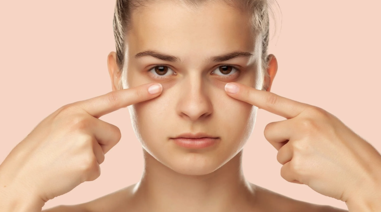 Dark Circles No More: Non-Surgical Solutions That Deliver Results