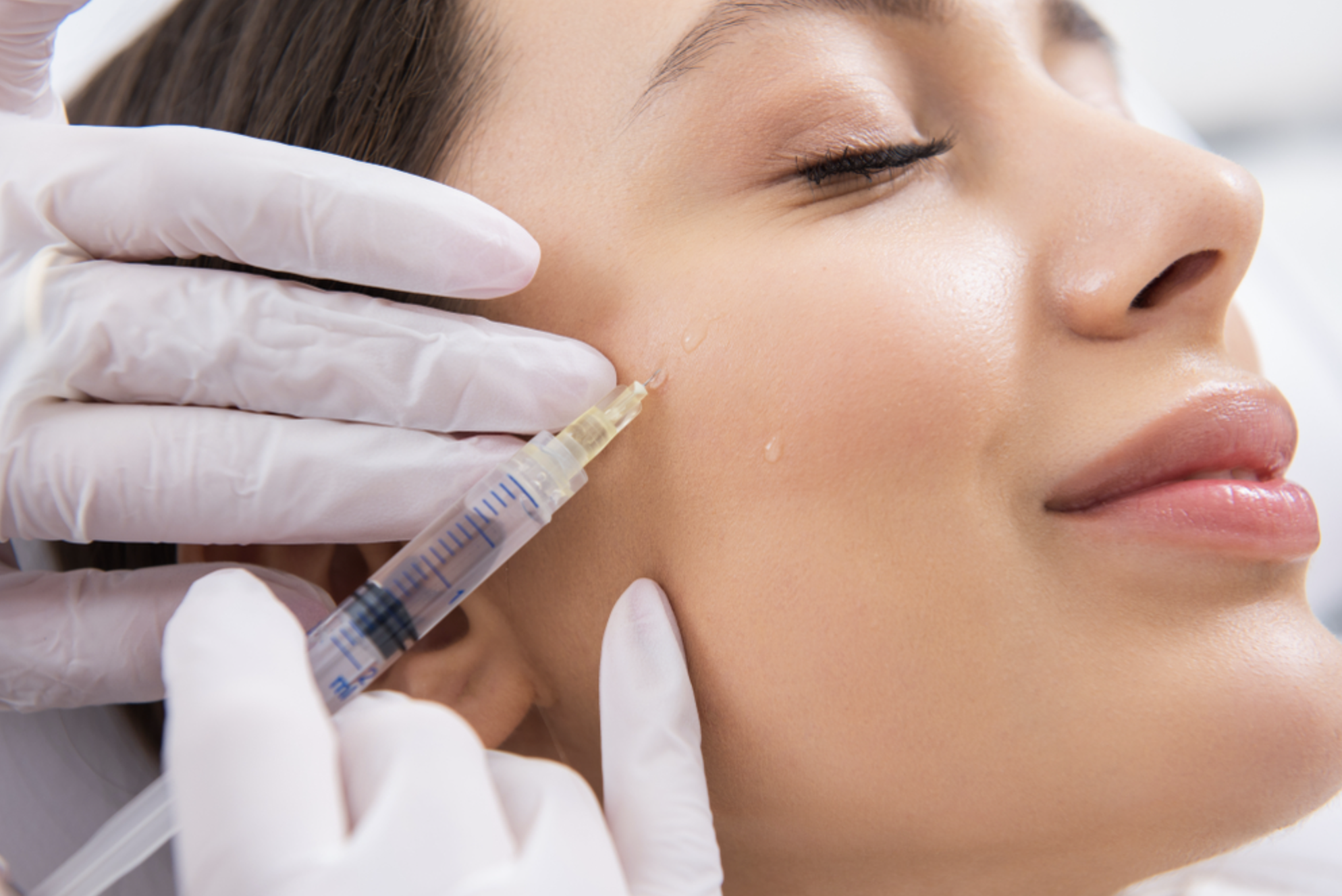 How Long Does HA Filler Actually Last? What Most Patients Aren’t Told