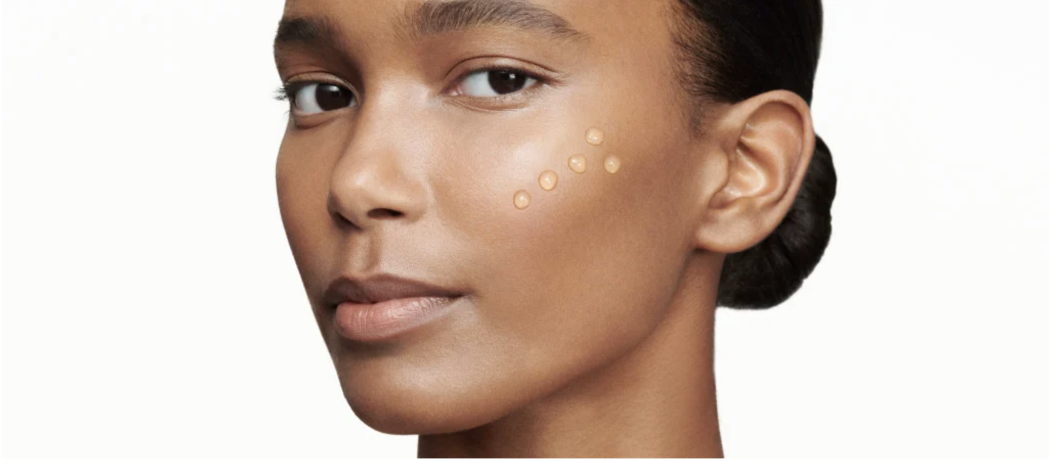 Cheek Filler: Lift vs Volume (There’s a Difference)