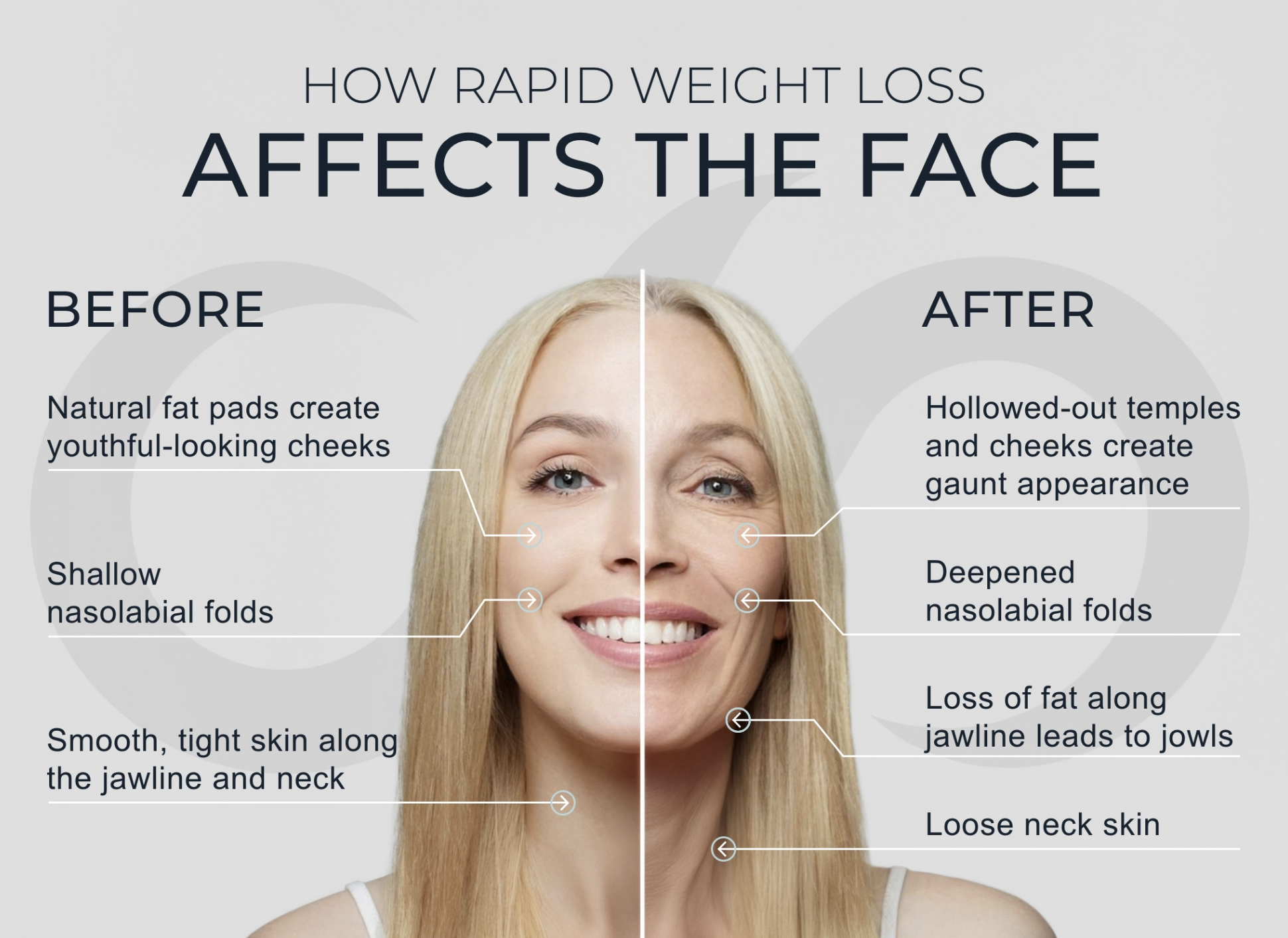 Sculptra for Weight Loss Faces: Why Filler Isn’t Enough