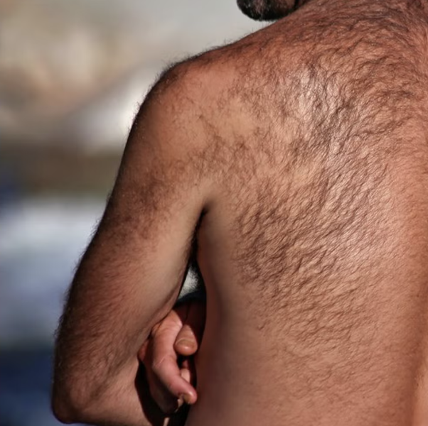 How Many Laser Hair Removal Sessions Do You Actually Need?