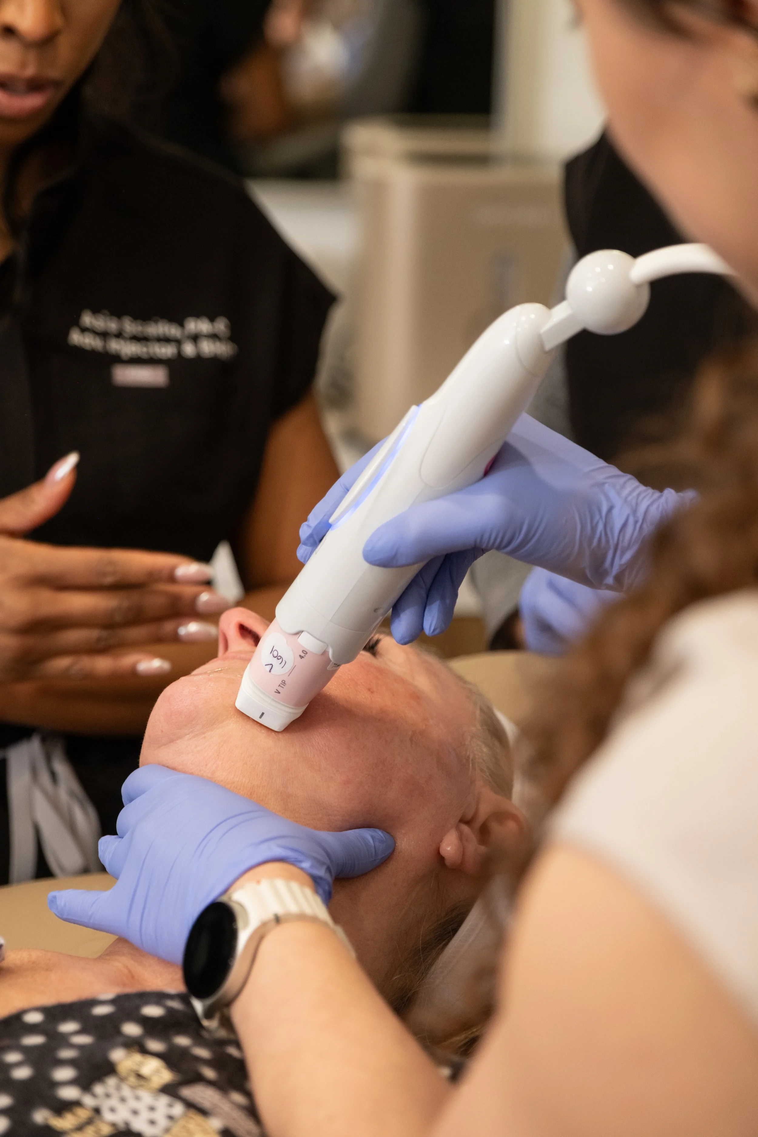 VI Peel for Acne: Why It Works When Nothing Else Does