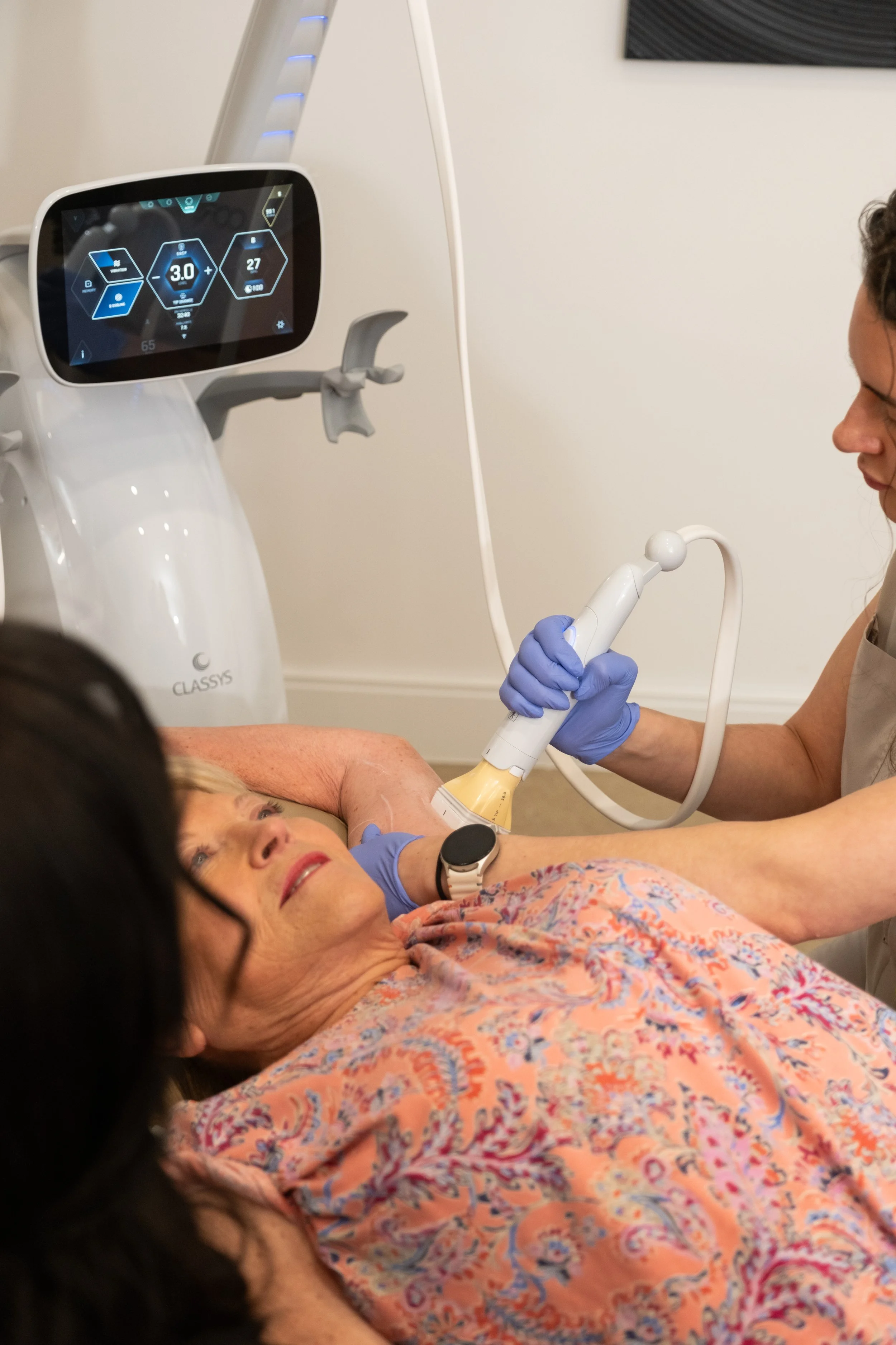 IPL for Redness: How to Finally Calm Rosacea-Prone Skin