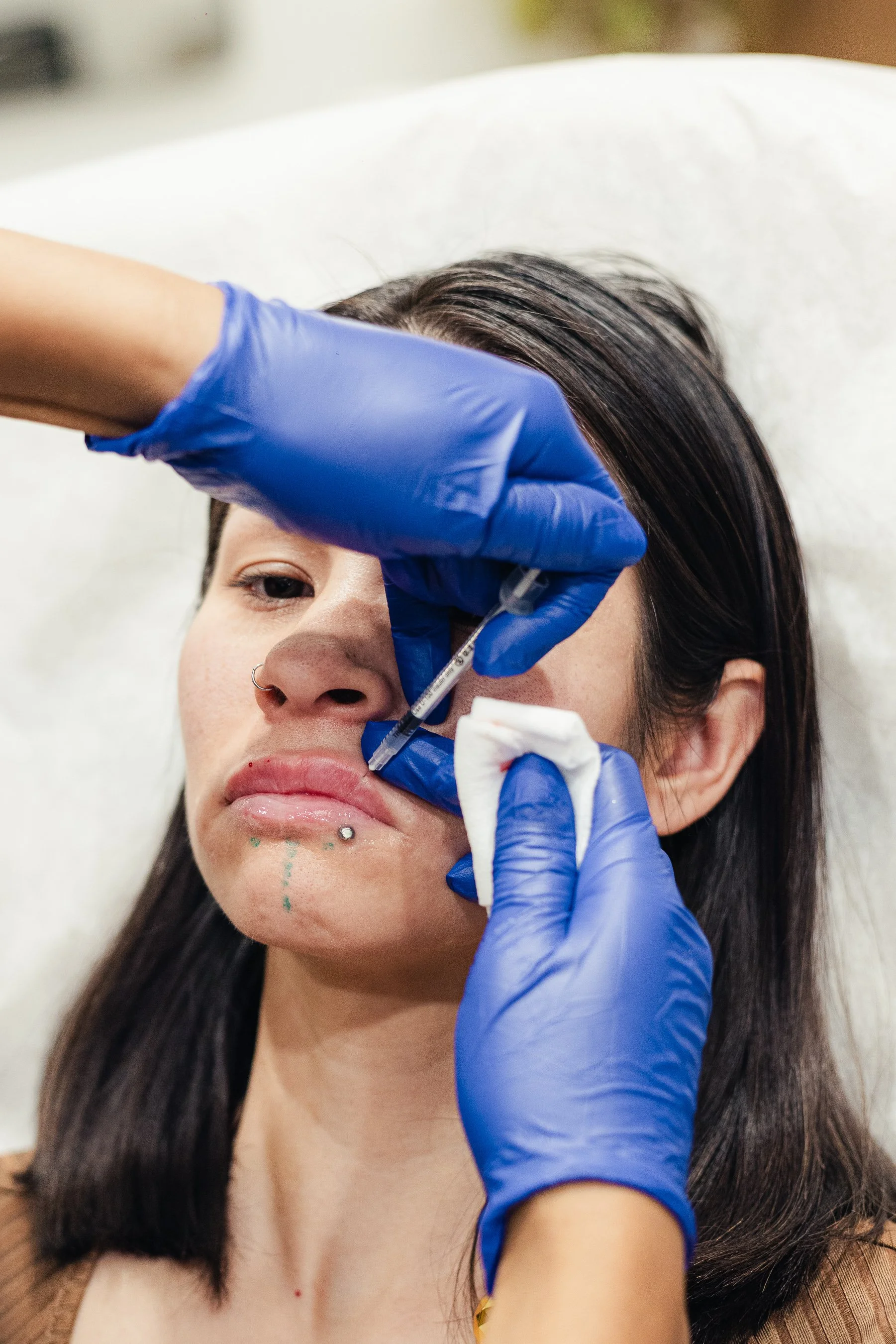 Close-up of a woman receiving a lip injection, with a professional in blue gloves administering the procedure.