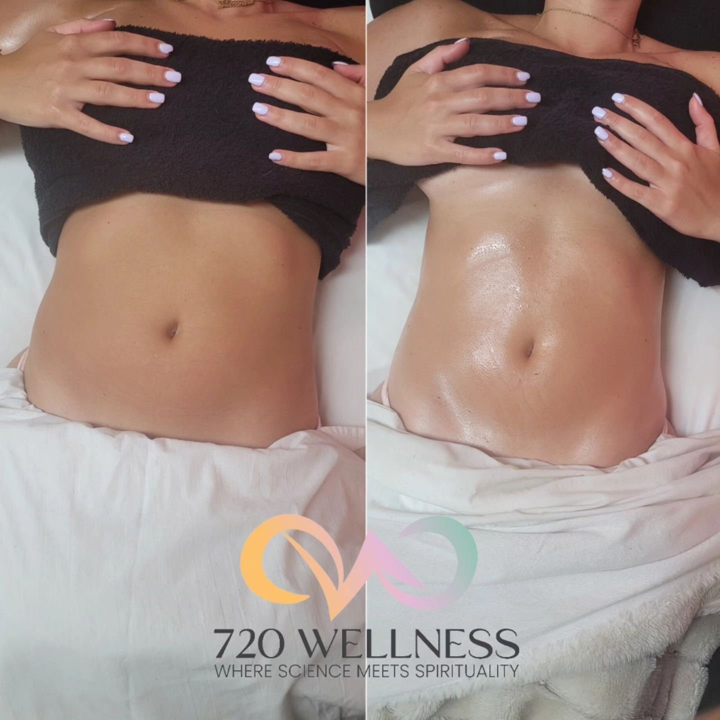WHY BRAZILIAN LYMPHATIC?

Brazilian Lymphatic Drainage is more than just a trend&mdash;it&rsquo;s a transformative wellness practice! 🌿 This powerful technique helps:

✨ Boost Immunity: Clears toxins and stimulates lymphatic flow for a healthier imm