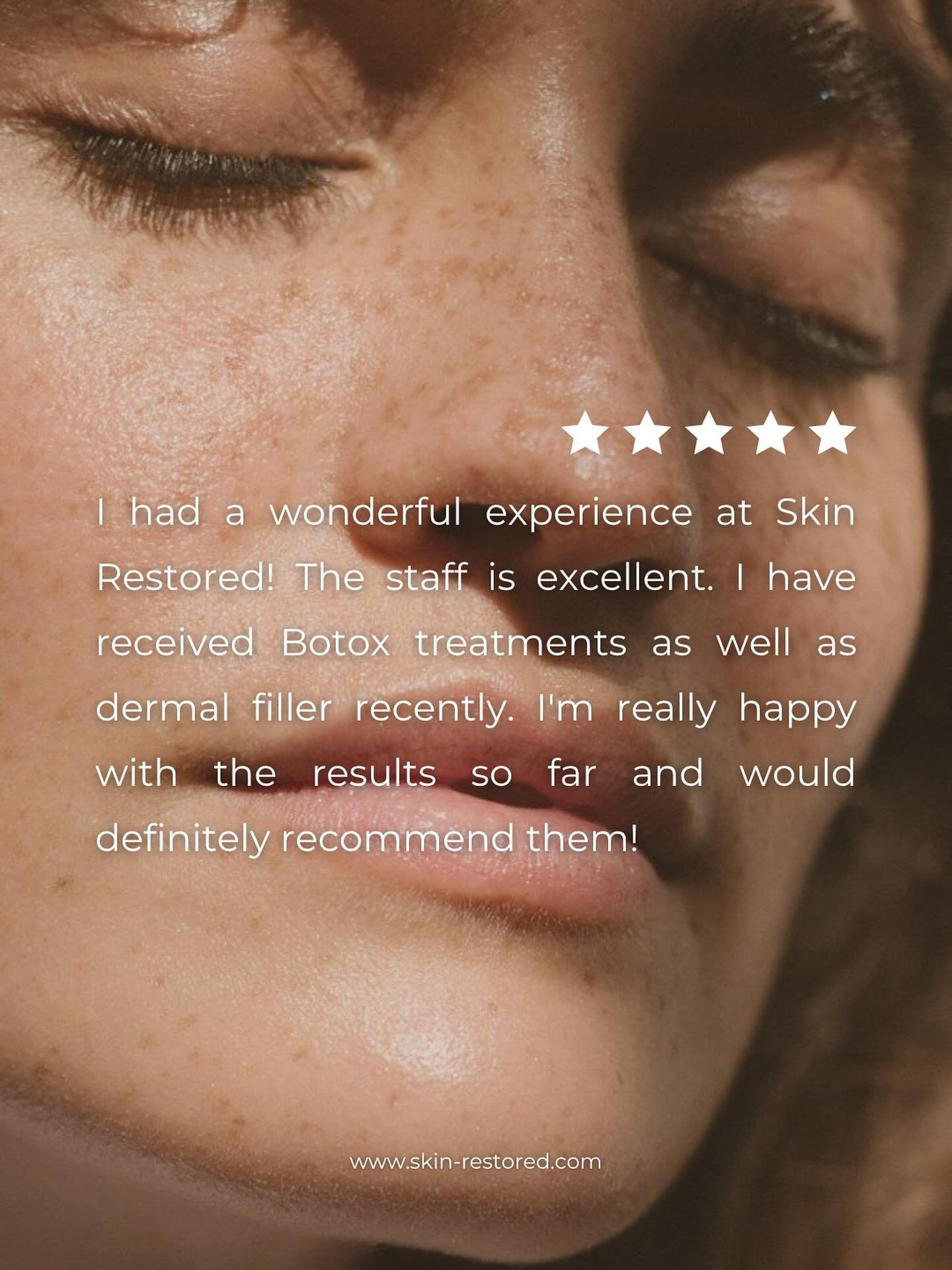 ⭐️⭐️⭐️⭐️⭐️
Another beautiful transformation and happy client at Skin Restored!

From Botox to fillers &mdash; our goal is always the same: helping you feel confident, refreshed, and naturally radiant.

Your trust means everything to us. Thank you for