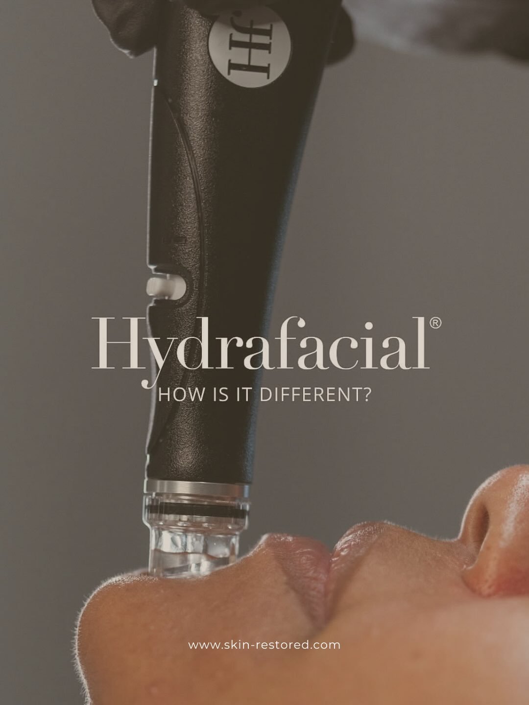 Hydrafacial = Instant Glow &amp; Healthy Skin
🌟 Custom boosters for every skin type
💦 Deep hydration, exfoliation, and nourishment
✨ Target aging, acne, and dullness
💡 Radiant, refreshed skin in just one treatment!

Glow this holiday season with a