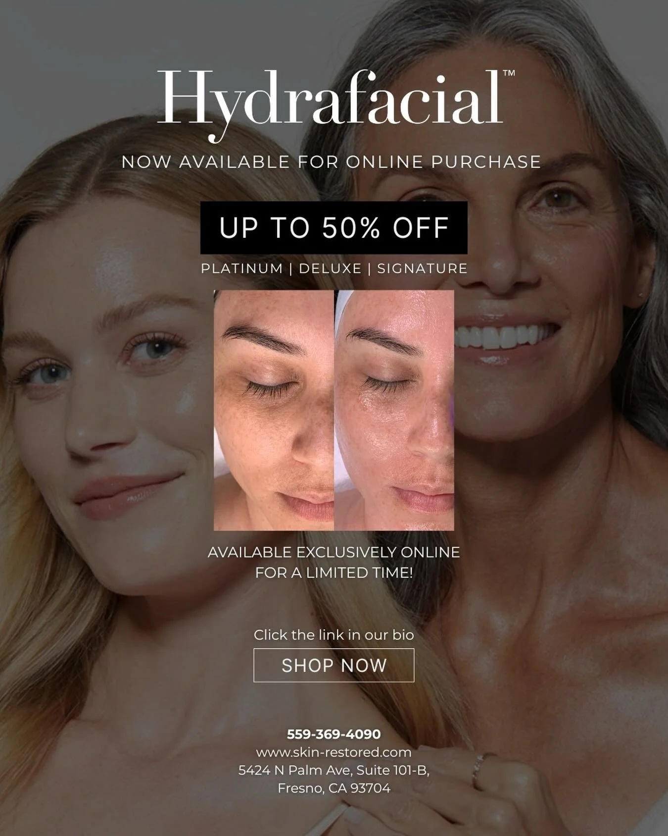 Hydrafacial is now available for online purchase at Skin Restored! ✨

Glow like never before with our Hydrafacial treatments &ndash; available in Platinum, Deluxe, and Signature. Treat your skin to a revitalizing experience that deeply cleanses, exfo