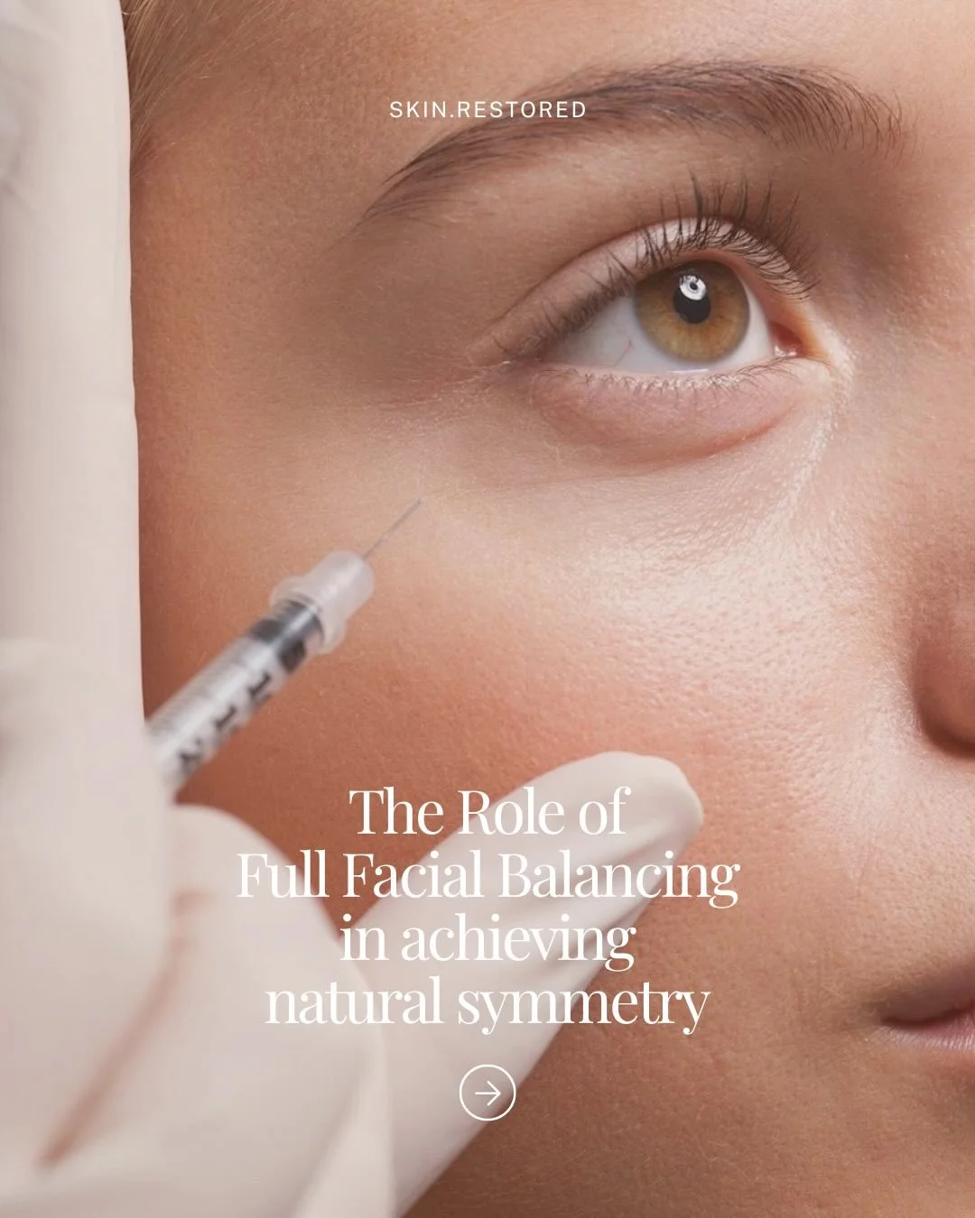 Are you ready to enhance your natural beauty? Full facial balancing takes a holistic approach to restore harmony across your features, ensuring results that look and feel effortlessly refined.

At Skin Restored, we believe in results that look like y