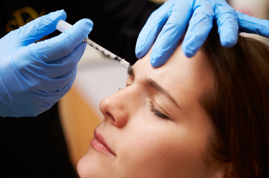 Preventative Botox: When, why, and how it works