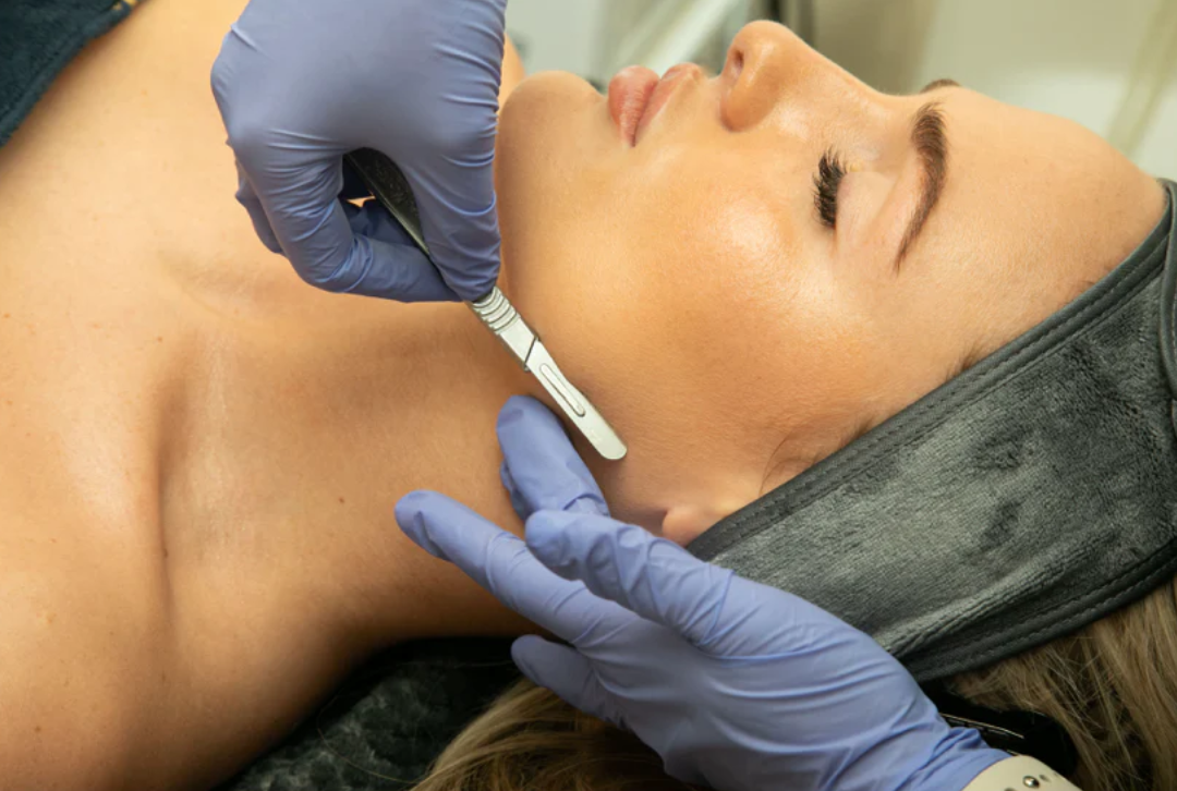 Is dermaplaning safe? What you need to know before your first treatment