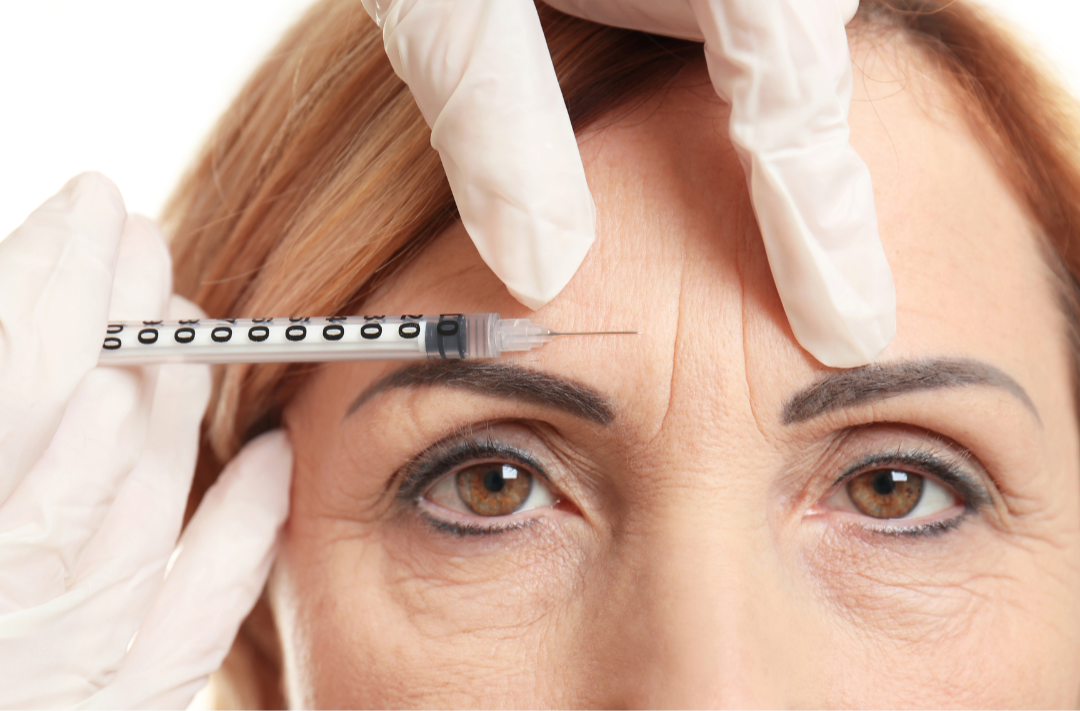 How Long Does Botox Last? A Fresno Patient's Guide