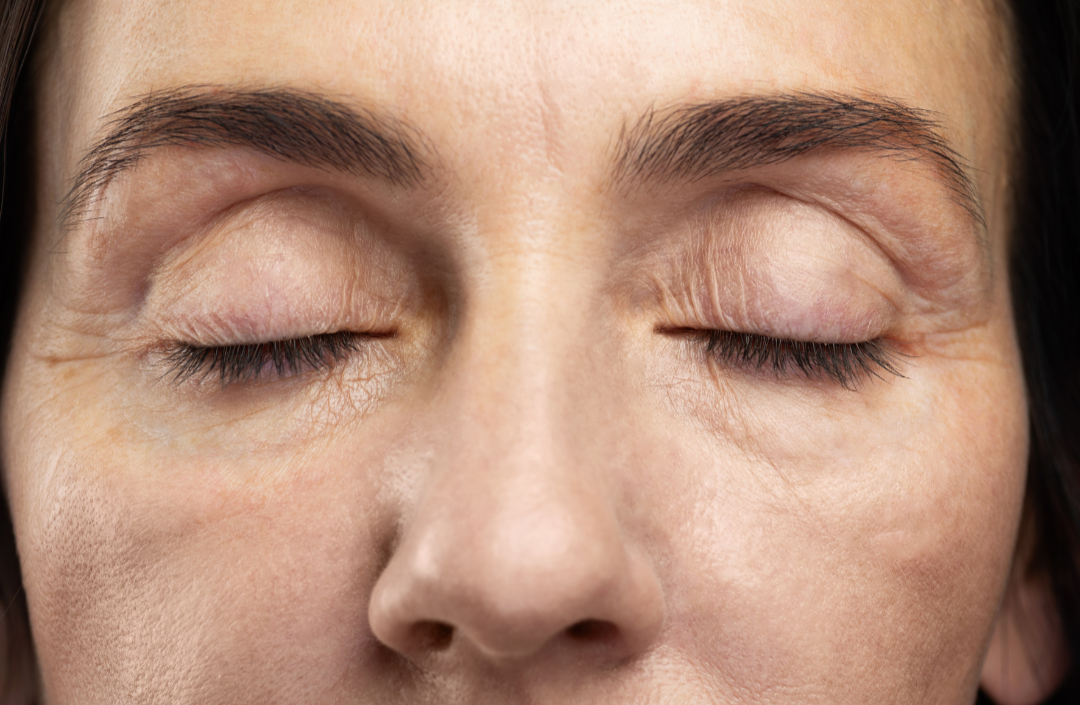Fine Lines and Early Aging: When to Start Treatment — SKIN.RESTORED