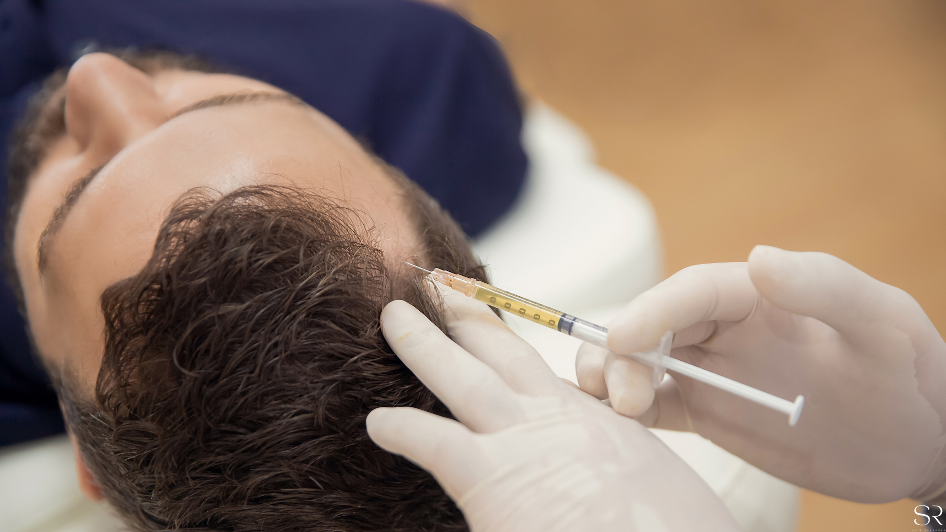 PRP Injections | Revitalize Your Skin Today — SKIN.RESTORED