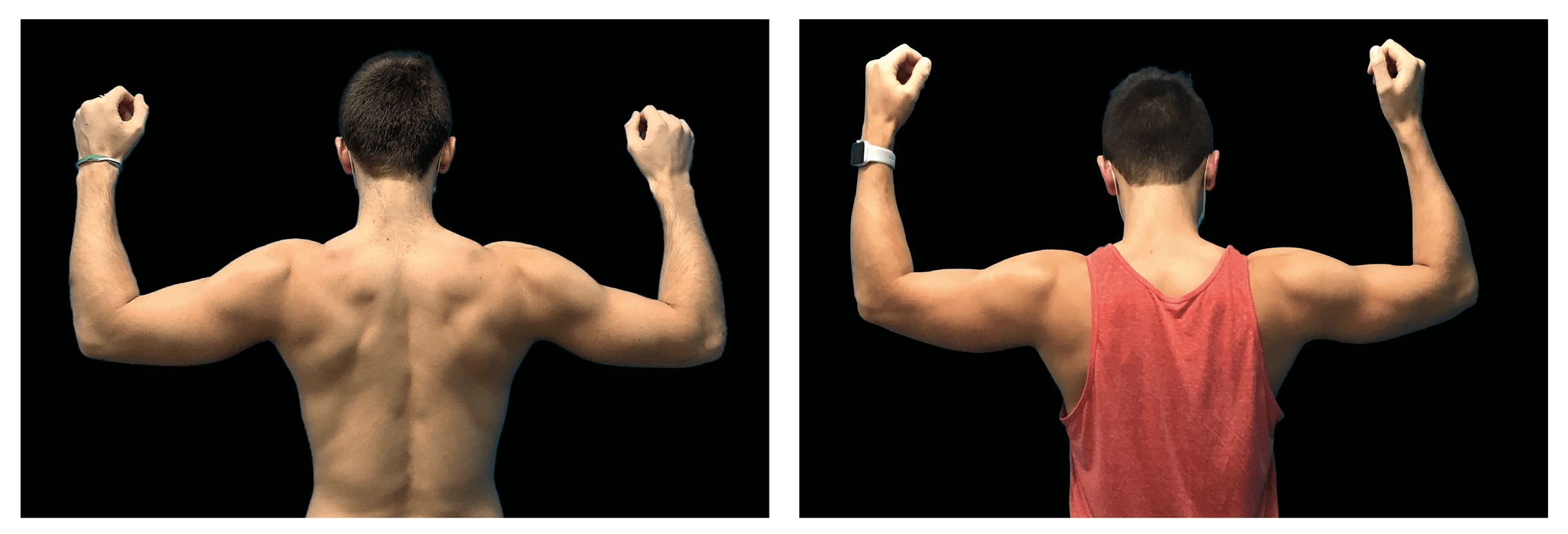 Emsculpt Nantucket (7).png