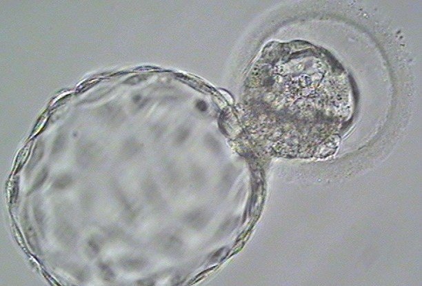 Fresh vs. Frozen IVF Cycles: Understanding the Key Differences