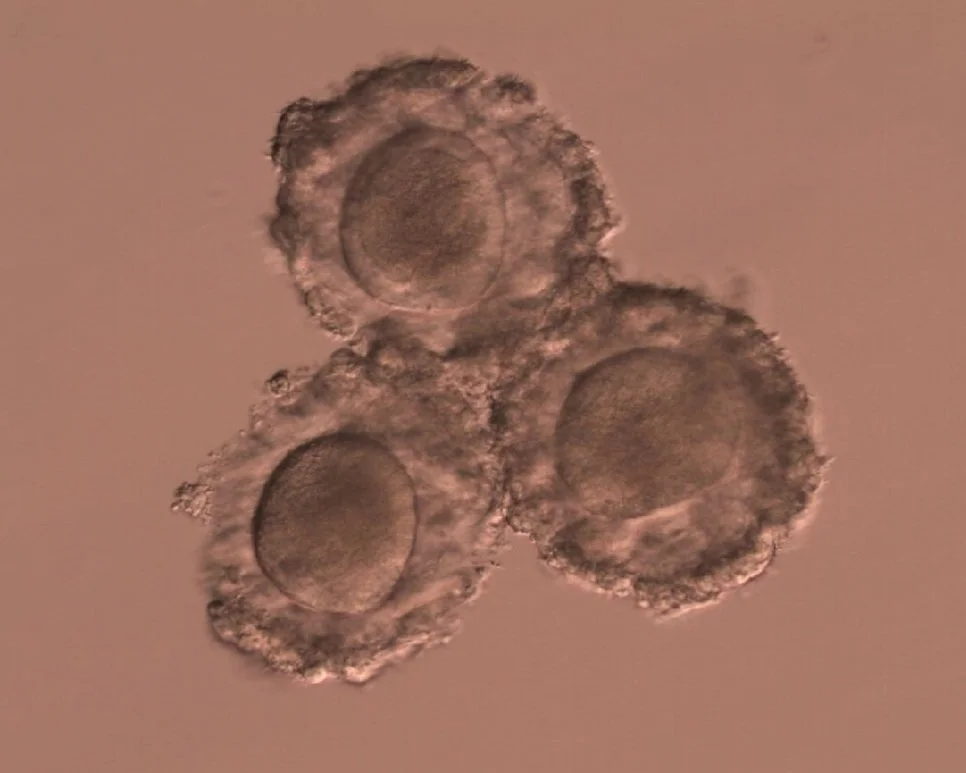 Decoding Egg Maturity: How Labs Classify MII, MI, and GV Stage Oocytes