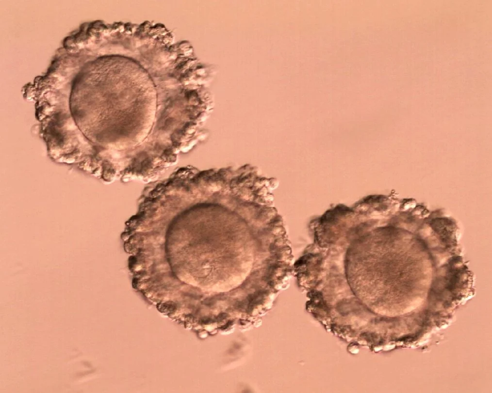 How Long Can Eggs Survive in Culture? In Vitro Maturation (IVM) Time Limits & Egg Viability