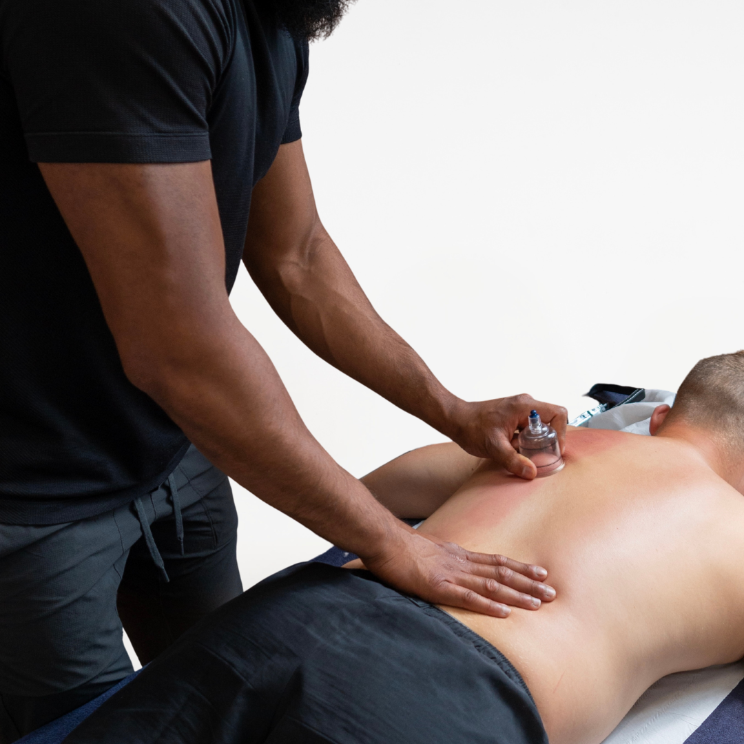 A therapist performing cupping therapist at Dr Stretch in Islington